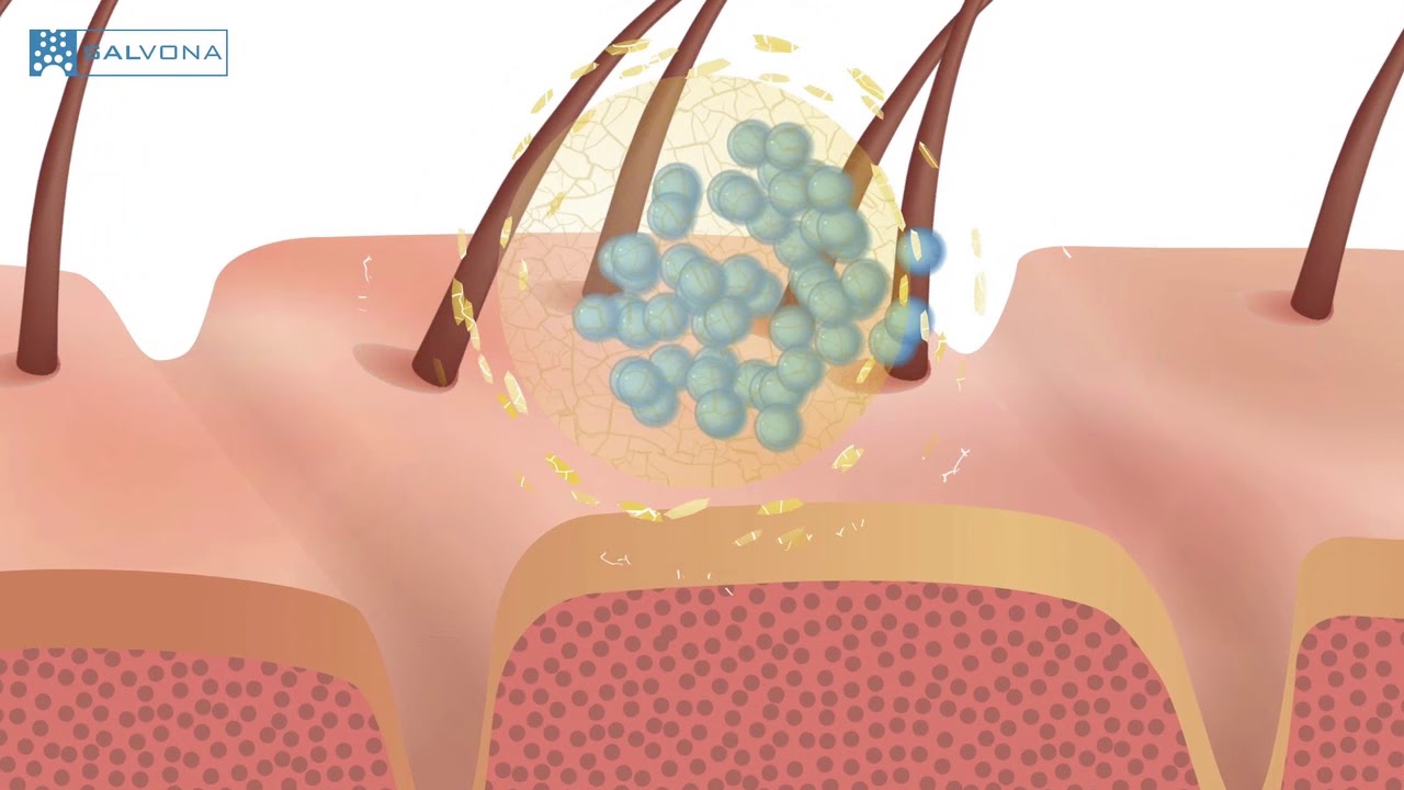 Animation: 2149 - MultiSal Retinol