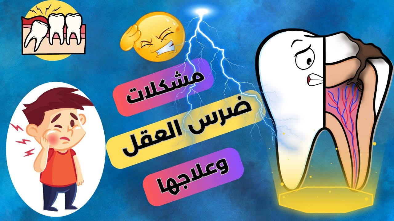 علاج الاسنان | مشكلات ضرس العقل وعلاجها؟| حكاية أسناني.