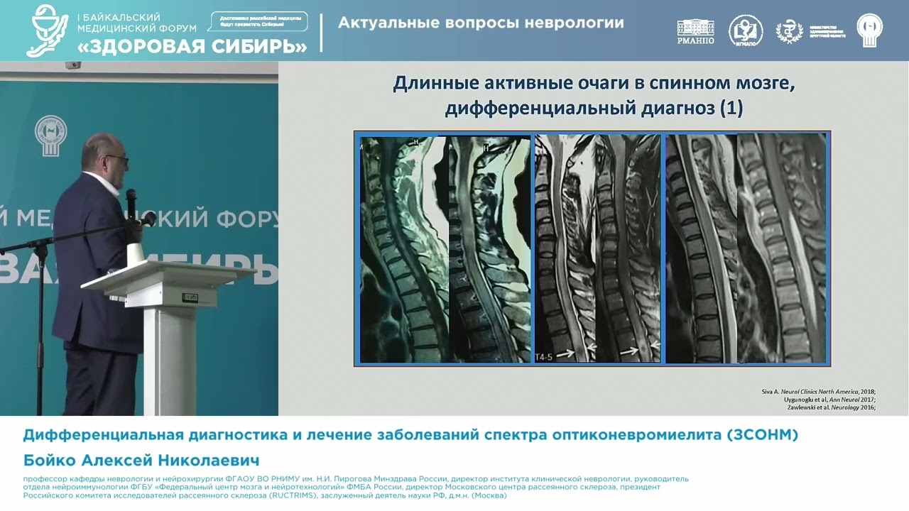 Бойко Алексей Николаевич Дифференциальная диагностика и лечение заболеваний спектра оптиконевромиели