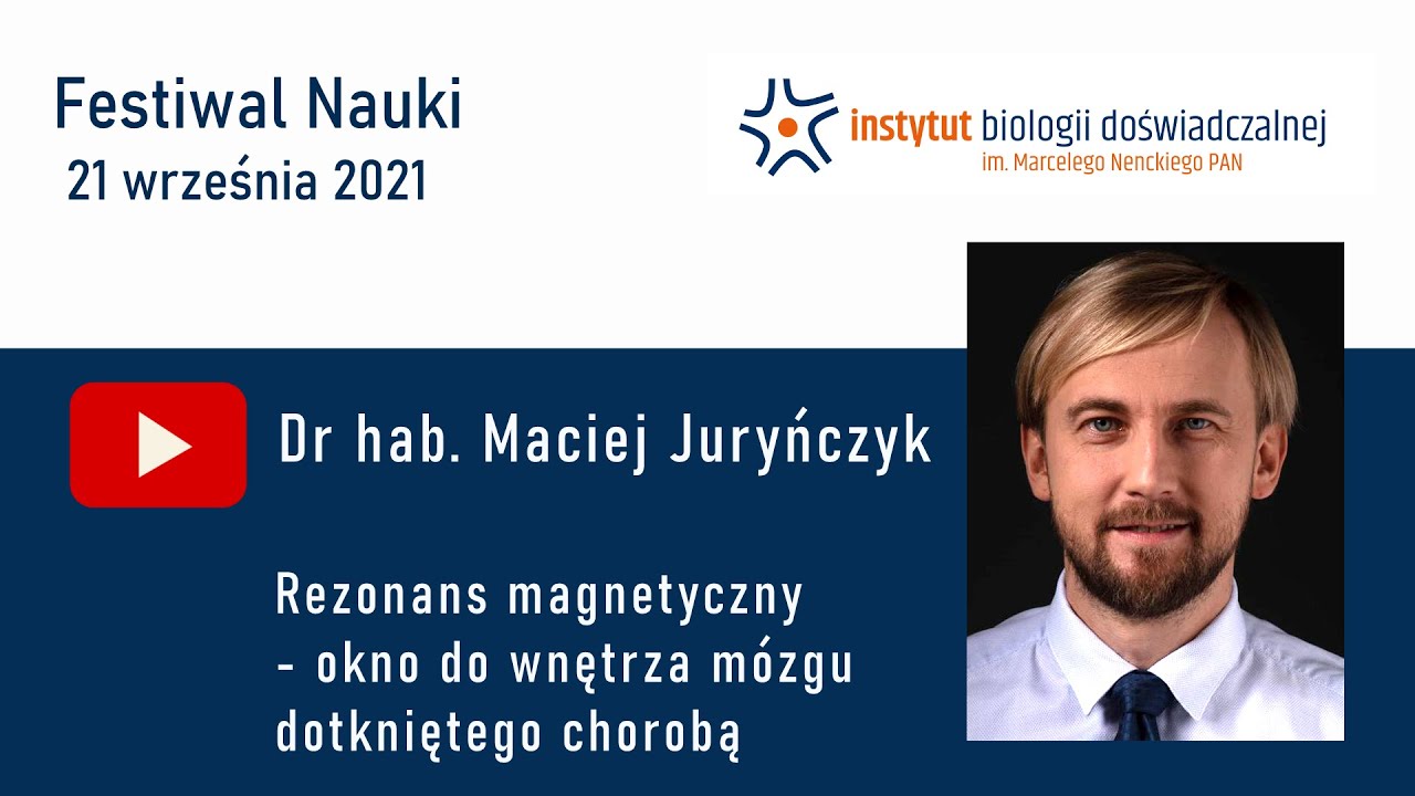 Rezonans magnetyczny – okno do wnętrza mózgu dotkniętego chorobą