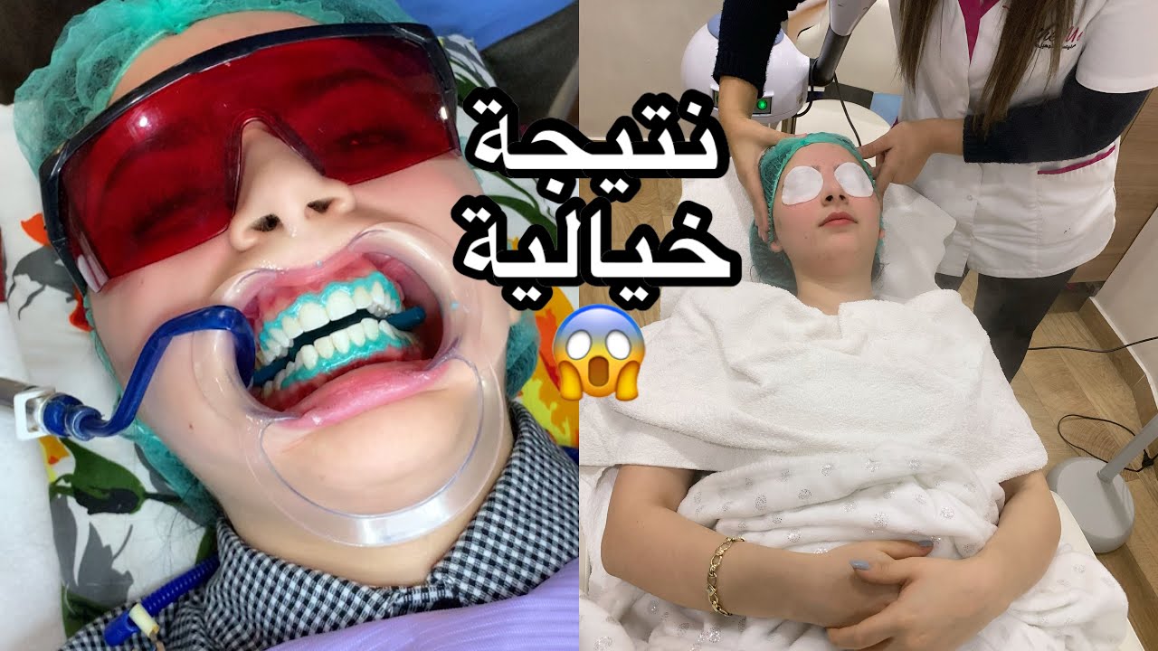 من الخطبة للعرس😱تجهيزاتي بمناسبة عرس اختي، تهليت ودلعت راسي | تصدمت من الشكل النهائي 😱