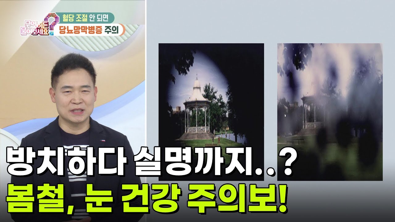 [닥터의 경고] 방치하다 실명까지..? 봄철, 눈 건강 주의보! (당뇨망막병증, 백내장) [무엇이든 물어보세요] | KBS 260316 방송