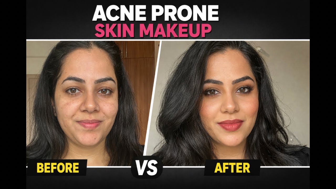 Makeup for Acne Prone Skin | Makeup on Sensitive Skin #acne #acneproneskin #makeuptutorial