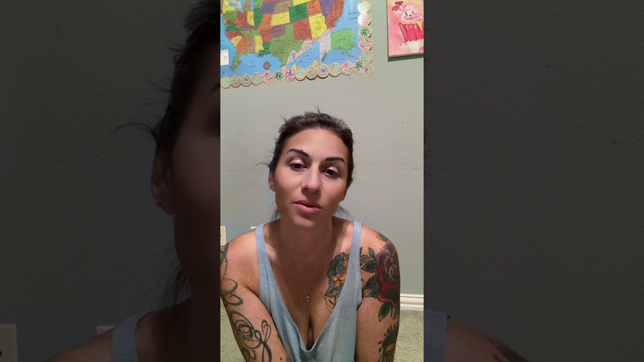 Update-Day 7 revision of below the knee amputation.