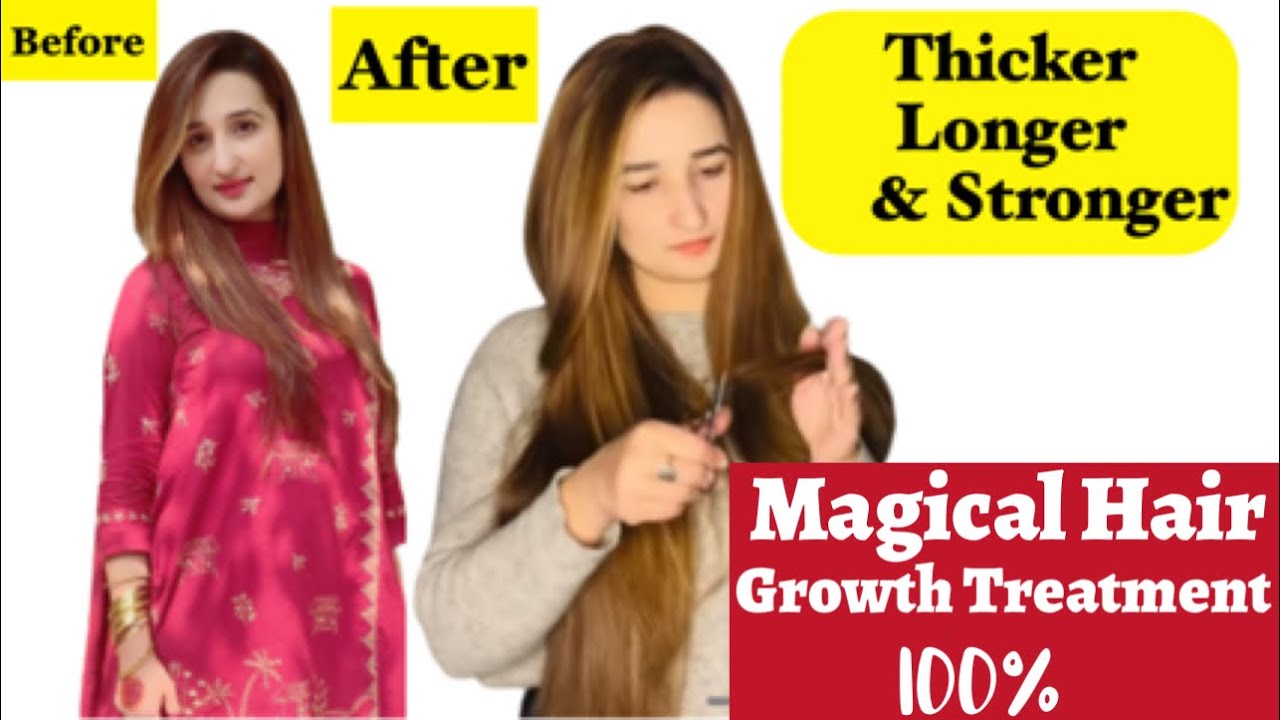 Grow Hair Faster || Magic Trick For Growing Long Hair || Long Thicken Hair World’s Best Hair Remedy