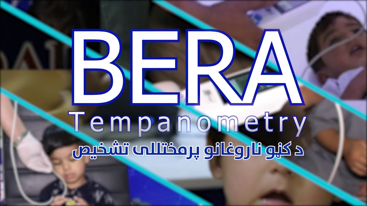 د کوچنیانو د غوږونو د ناروغیو عصري تشخیص د BERA په مټ | اډیولوژۍ څانګه | Sidal Hospital
