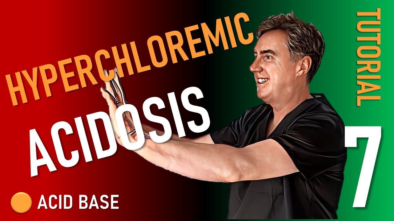 Hyperchloremic Acidosis