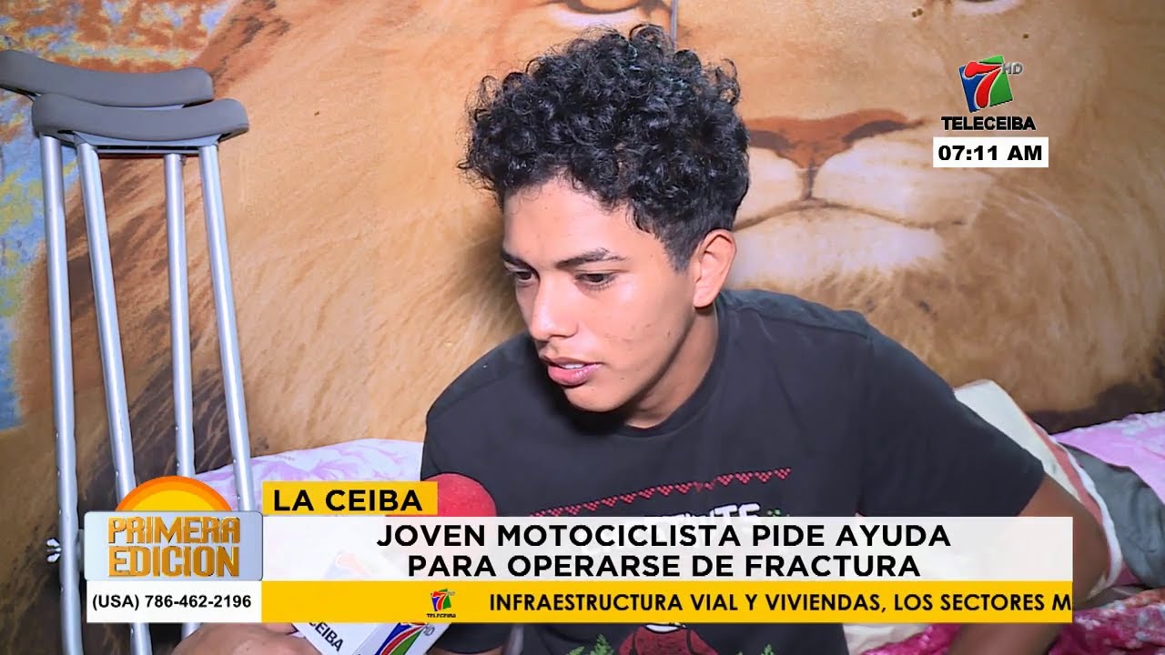 🛑 La Ceiba | Joven motociclista pide ayuda para operarse de fractura.