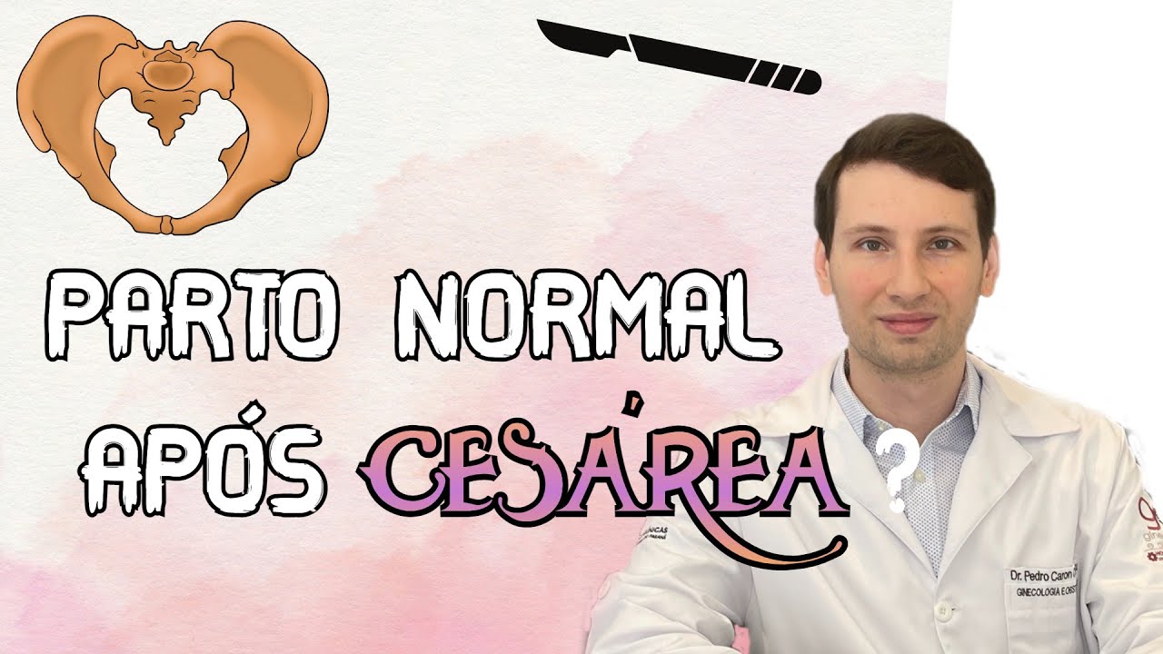 DESCUBRA PARTO NORMAL APÓS 1 CESÁREA, é possível?