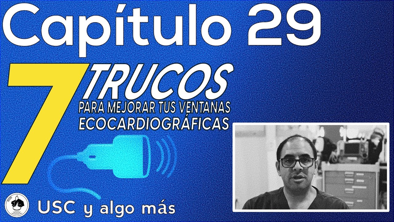 Capítulo 29: 7 consejos para mejorar tus ventanas cardíacas