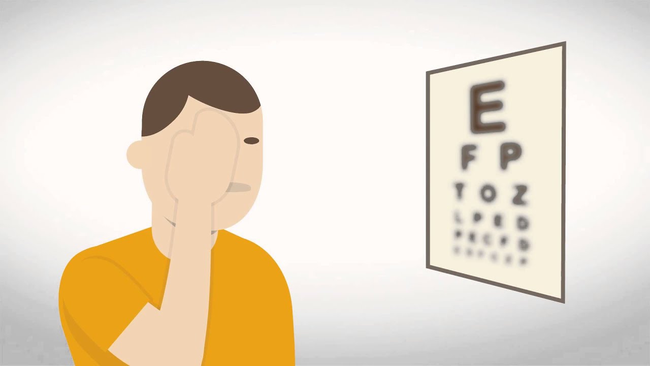 Straight Talk Acromegaly