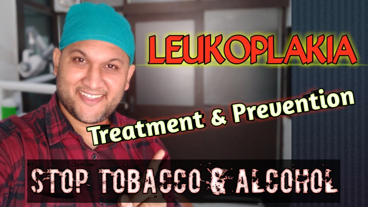 Leukoplakia:Treatment & Prevention | मुंह में सफेद दाग के लक्षण, कारण, इलाज | Oral Hairy Leukoplakia
