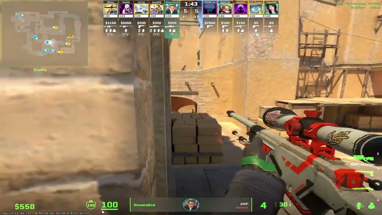 awp editzzzzzzzz