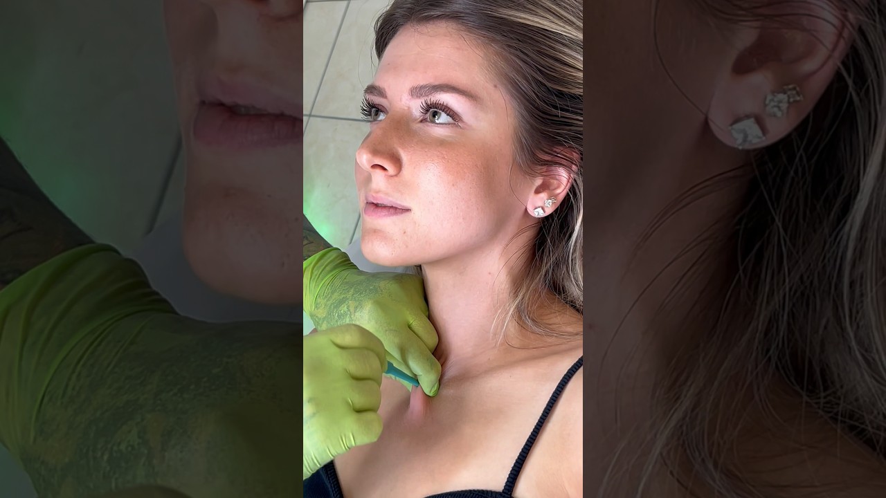 FAST MICRODERMAL PIERCING!