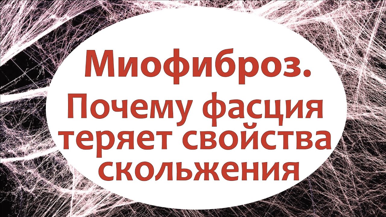 Миофиброз. Почему фасция теряет свойства скольжения