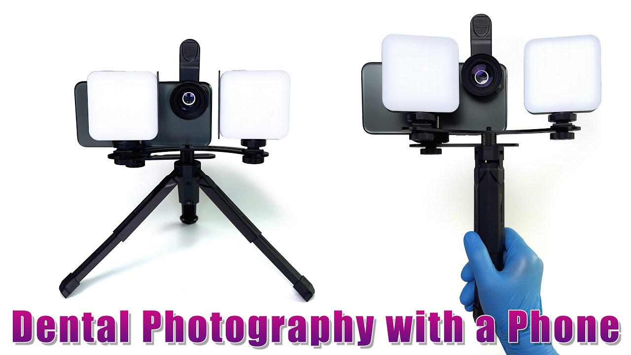 Dental photos with a mobile phone - MK-019 fill light for dentists - Tripod, Bluetooth, Macro lens