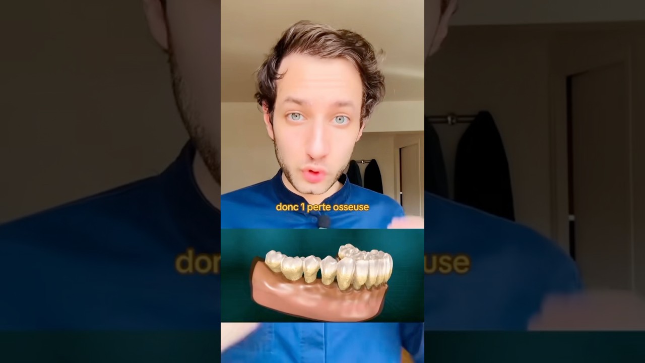 LA PARODONTITE GENETIQUE PARFOIS MAIS PAS QUE ! 🦷 #dentiste #parodontite #extractions