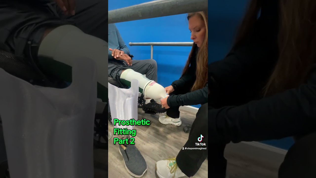 Prosthetic Fitting - Part 2