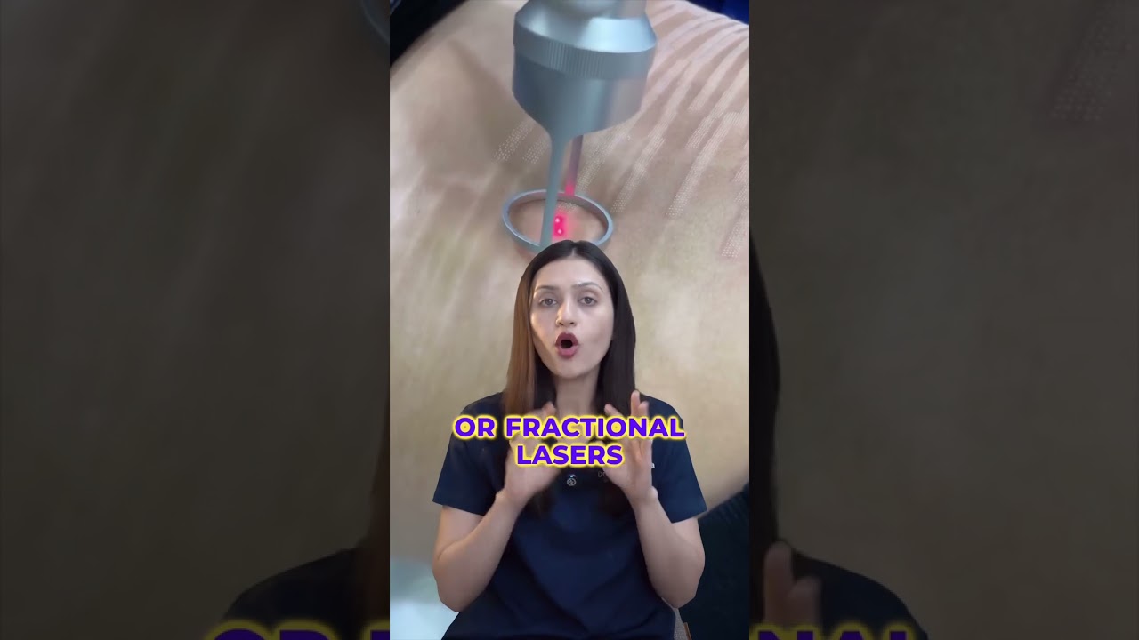 Stretch Marks Treatment: Effective Solutions for Clearer Skin | Dr. Sarin |