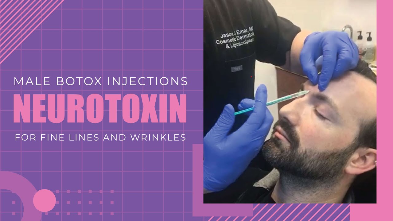 Male Botox Injections | Neurotoxin for Fine Lines and Wrinkles | Jason Emer