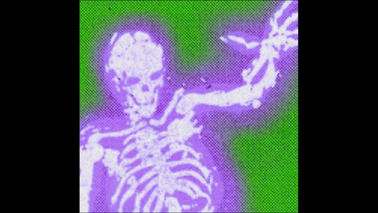 *FREE FOR PROFIT* juice wrld x ssgkobe type beat 