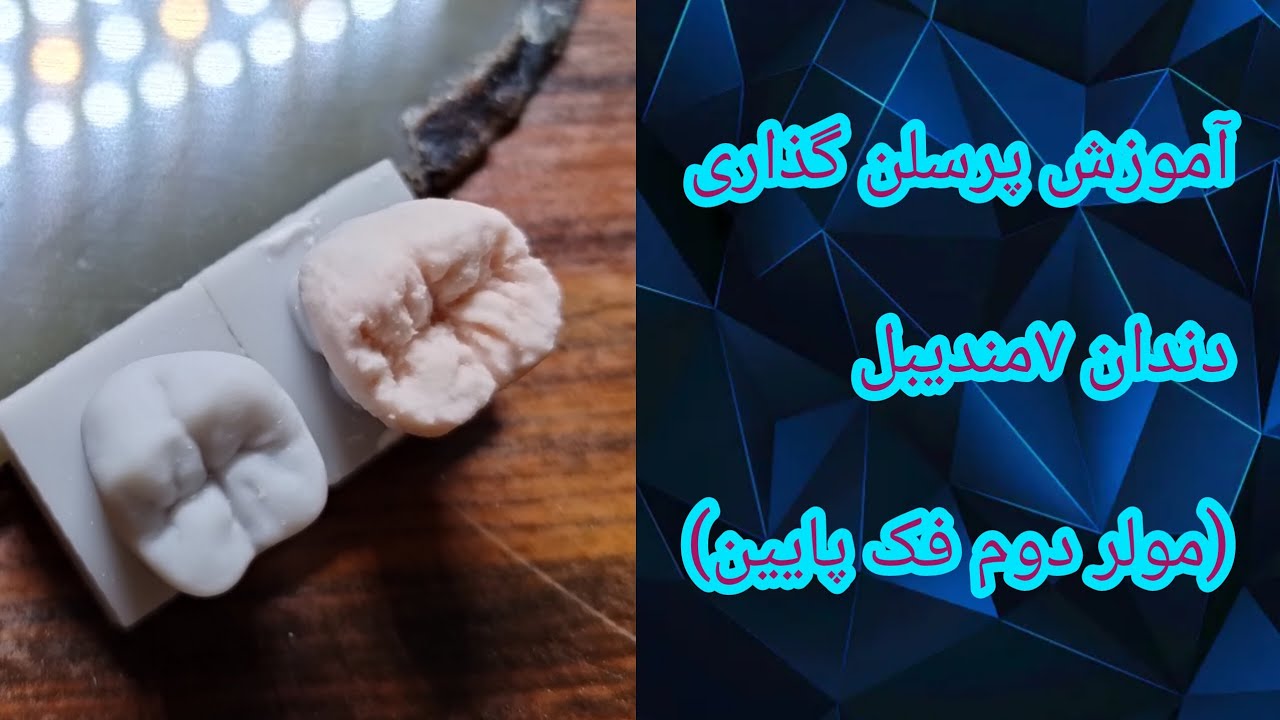 🔥آموزش پرسلن گذاری دندان 7 مندیبل (مولر دوم فک پایین) | تکنیک پودر گذاری| آموزش تخصصی دندانسازی🤍🦷🖌️