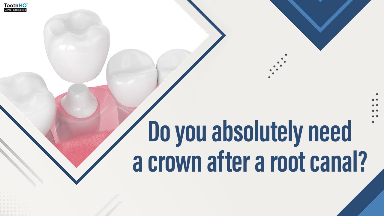Do you absolutely need a crown after a root canal? Implants & Gumcare CEO Dr. Vadivel DDS
