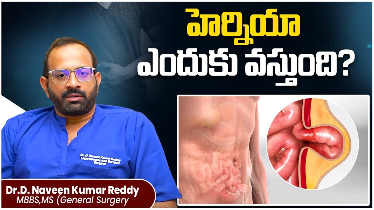 హెర్నియాకు కారణాలు || What is HERNIA? || Best Treatment for Hernia || TRH Laparoscopic Centre