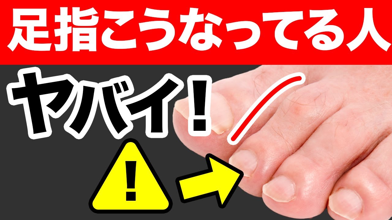 【危険】足指が丸まっている人に起こること！ハンマートゥの原因とセルフケア｜鍼灸整体院リーフ｜足指ほぐし
