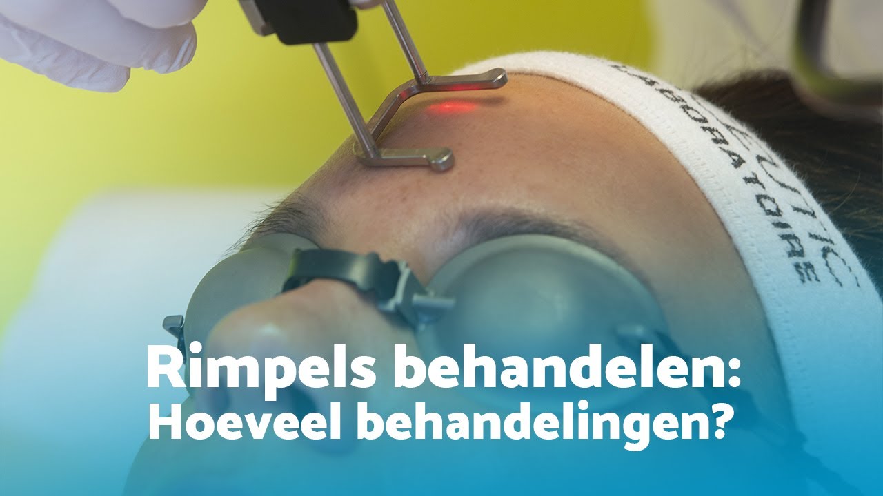 Hoeveel rimpel behandelingen zijn er nodig?