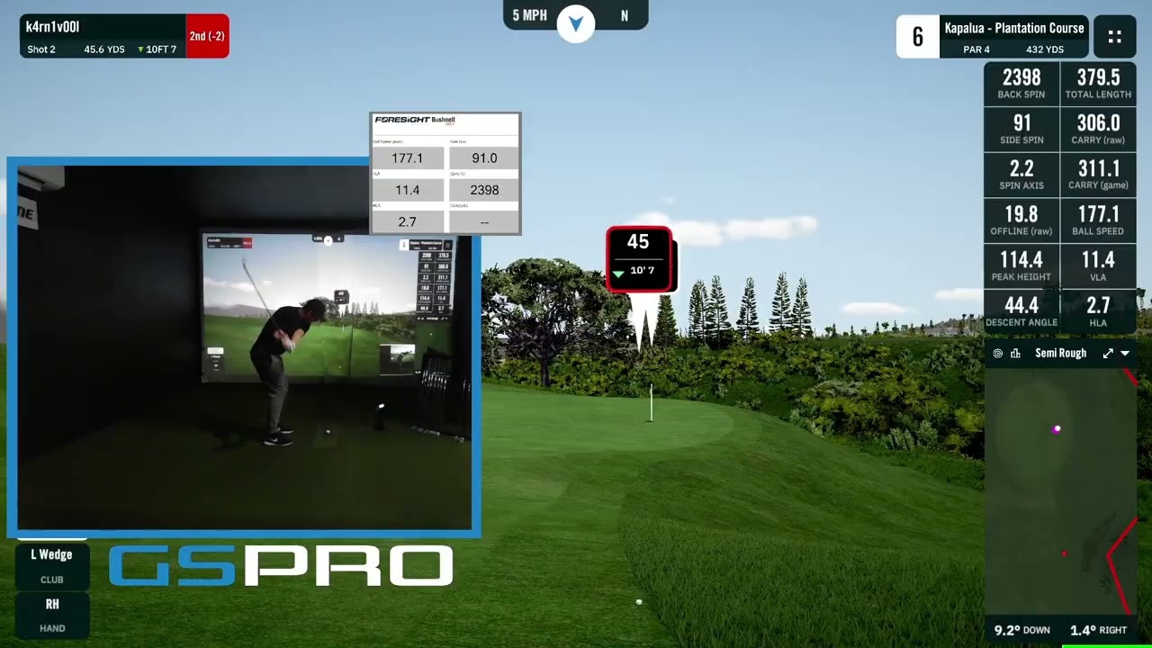 TIPS-R2-3 yips