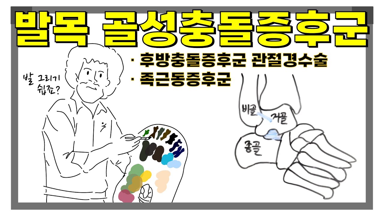 발목 골성충돌증후군 시리즈 15 - 후방충돌증후군 관절경수술, 족근동증후군