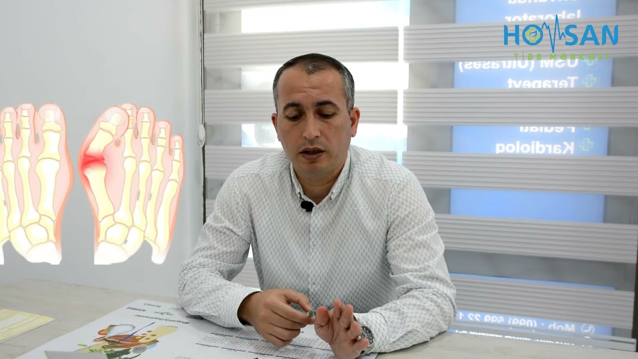 Hallux valgus 🩺➡️​​ Dr. Bəhram Qurbanov​ - Travmatolog Ortoped —​  Hövsan Tibb Mərkəzi