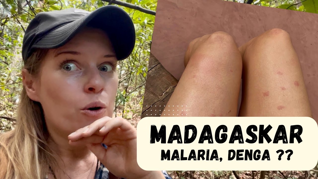 MALARIA? DENGA? Zachorowałam na Madagaskarze... Nosy Be 2025
