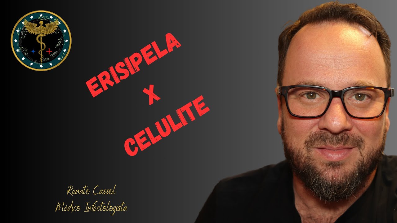 ERISIPELA E CELULITE - Renato Cassol Médico Infectologista