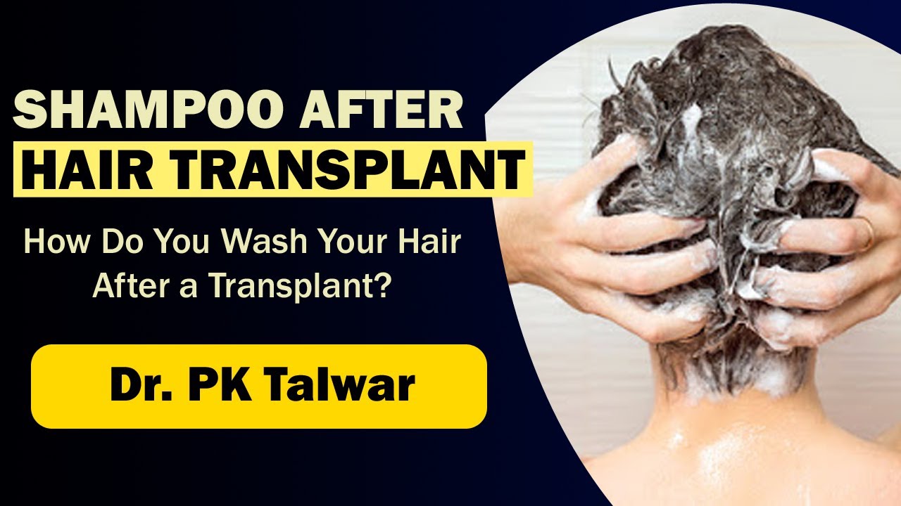 Can I Use Shampoo After A Hair Transplant? How to Wash Hair After Hair Transplant | Dr PK Talwar