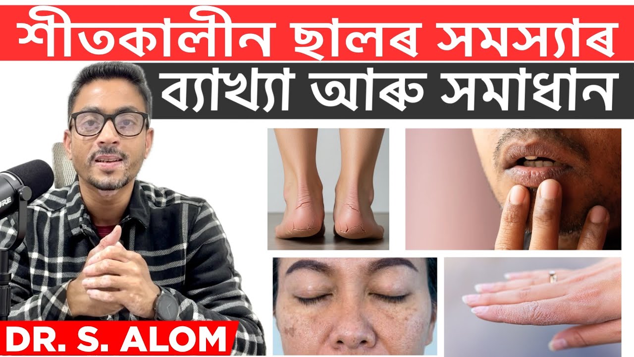 Your Skin Is Begging for Help — Winter Damage Explained