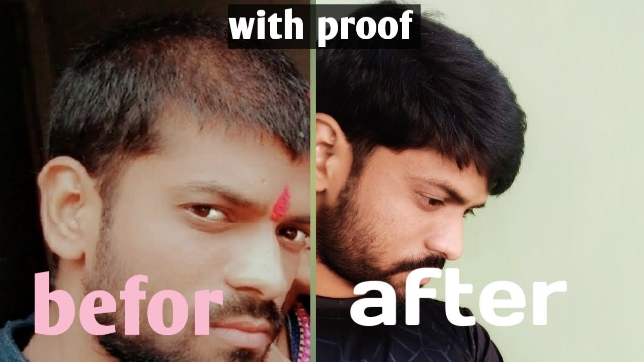 How to growth my hair faster || in hindi with proof ||