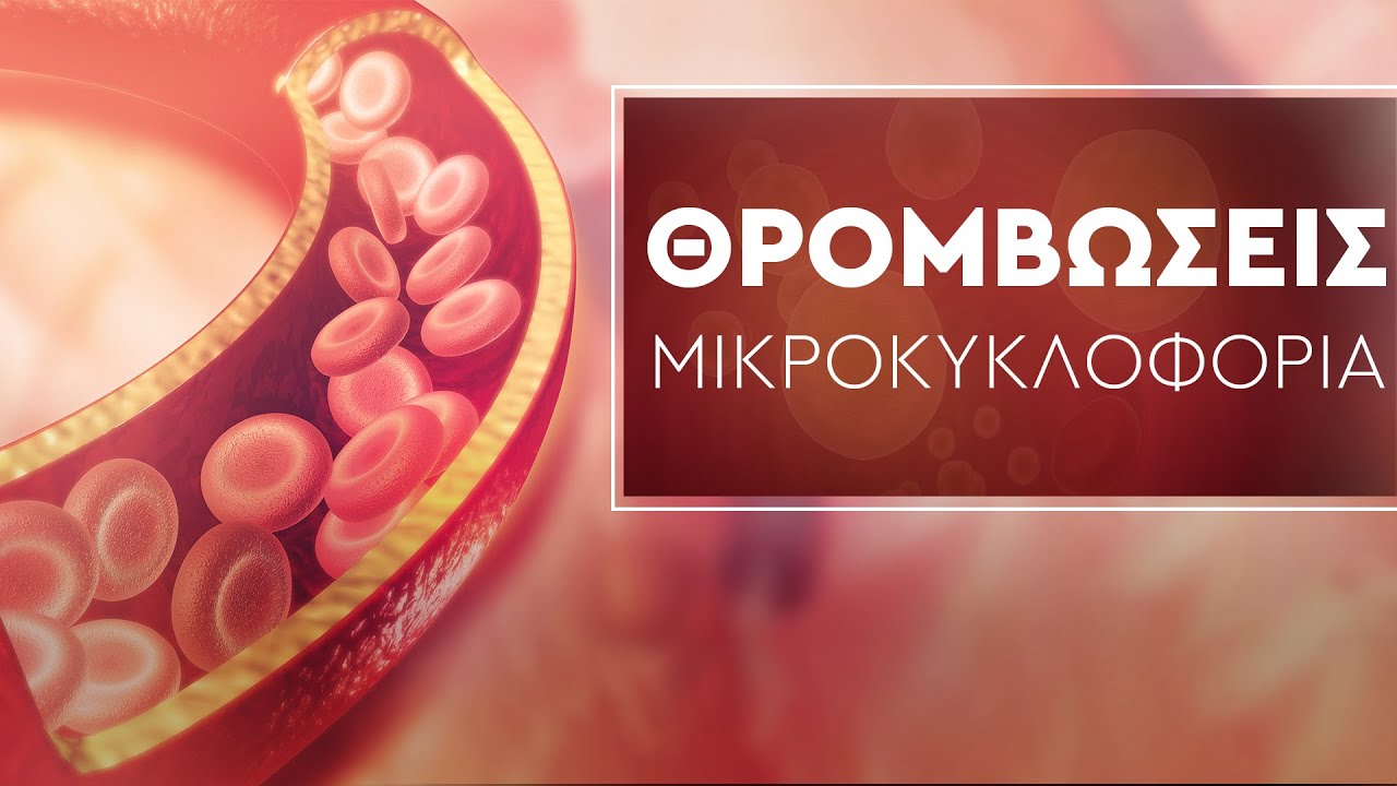 Θρομβώσεις & Μικροκυκλοφορία | Τι πρέπει να προσέξουμε!