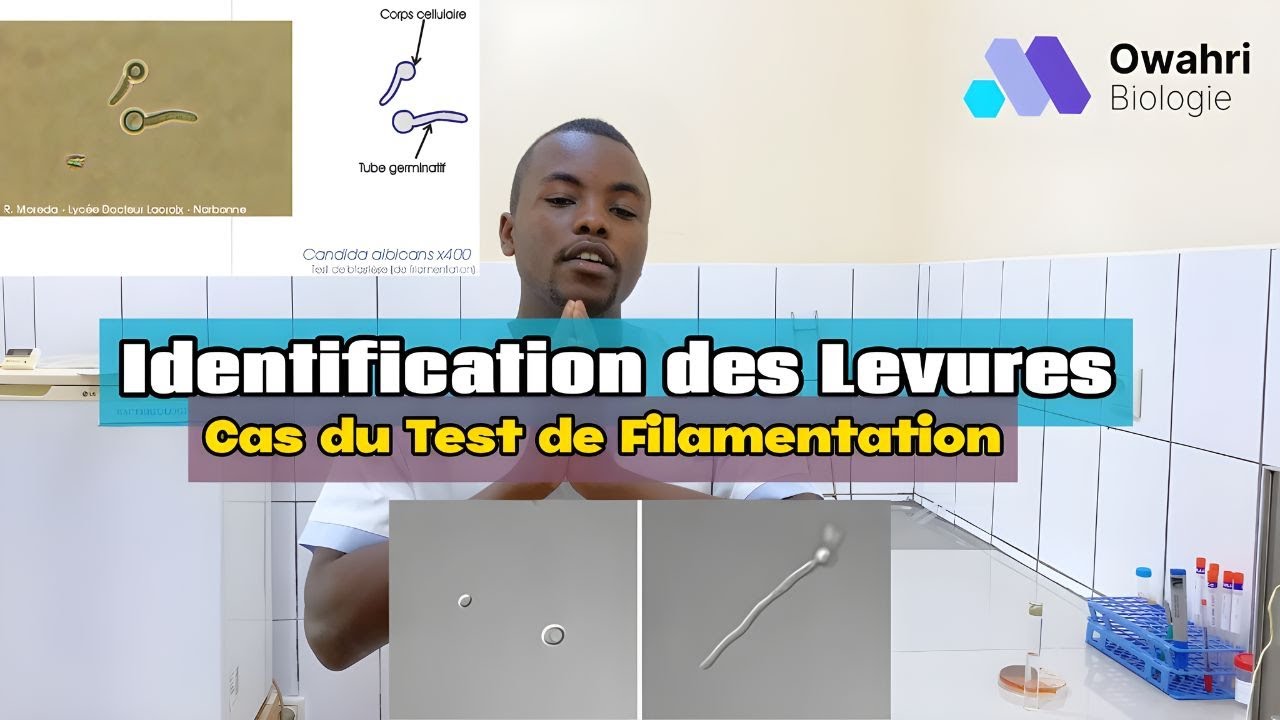 Comment R&eacute;aliser un Test de Filamentation : Tutoriel Pratique en Microbiologie