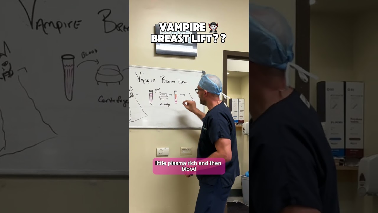 Vampire Breast Lift | Dr. Matthew J. Nykiel