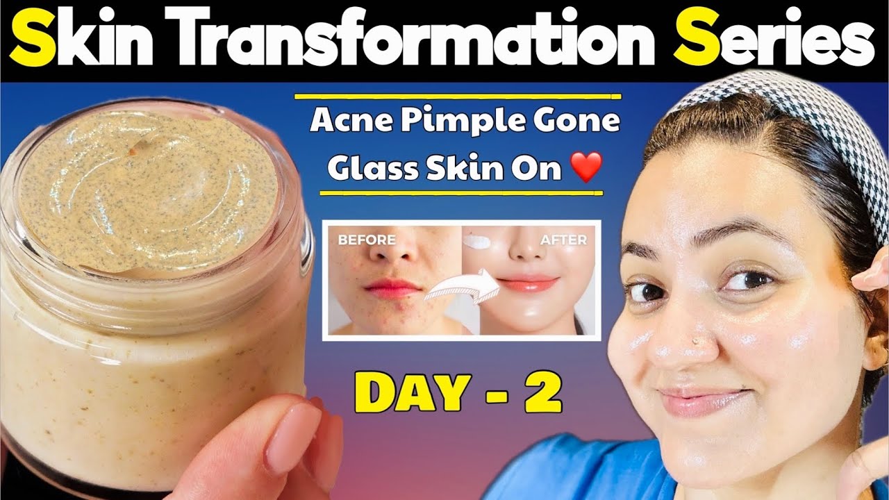 Glass Skin Transformation Series (Day 2) : Get Clear Healthy Glowing Spotless Glass Skin in 5 Days💕