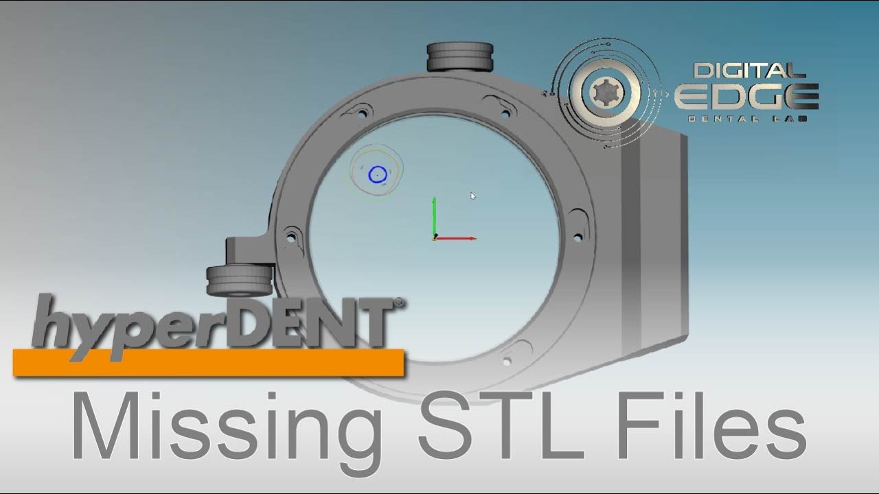 hyperDENT Tutorial: Missing STL Files