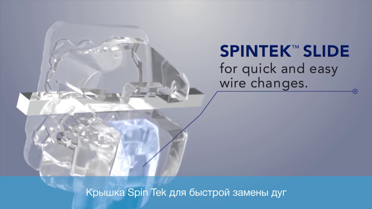 Новые керамические брекеты Damon Clear 2 в Клинике Конфиденция