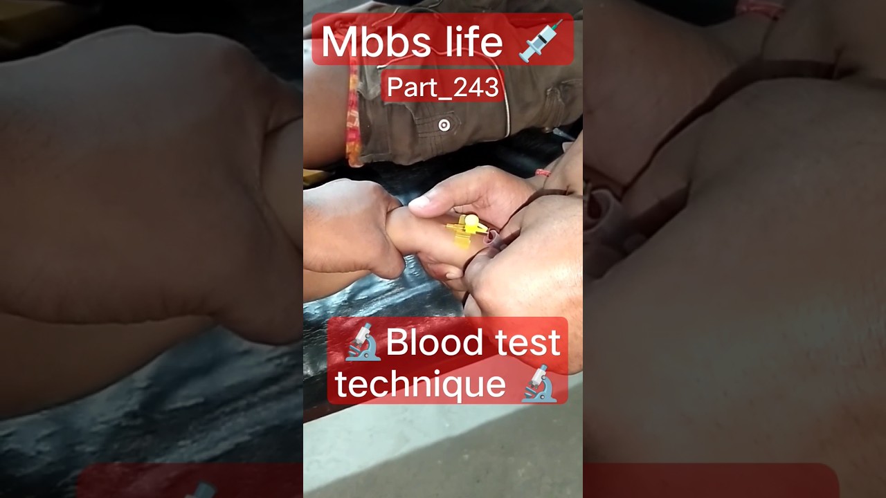 mbbs life 💉part _243 💉 blood test technique 🔬