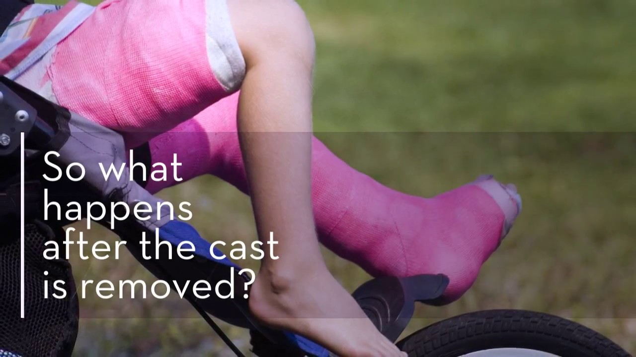 Physiquality blog: How does physical therapy help after a cast comes off?