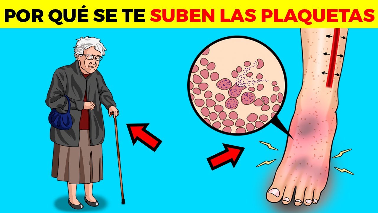 ¿Por qué TIENES PLAQUETAS ALTAS?, significado, causas, tipos y todo lo que debes saber
