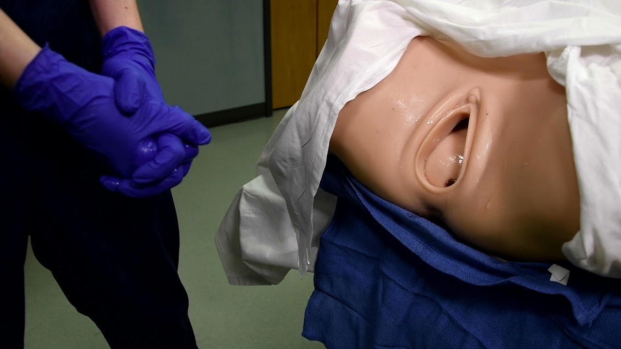 Breech Birth (Part 2)