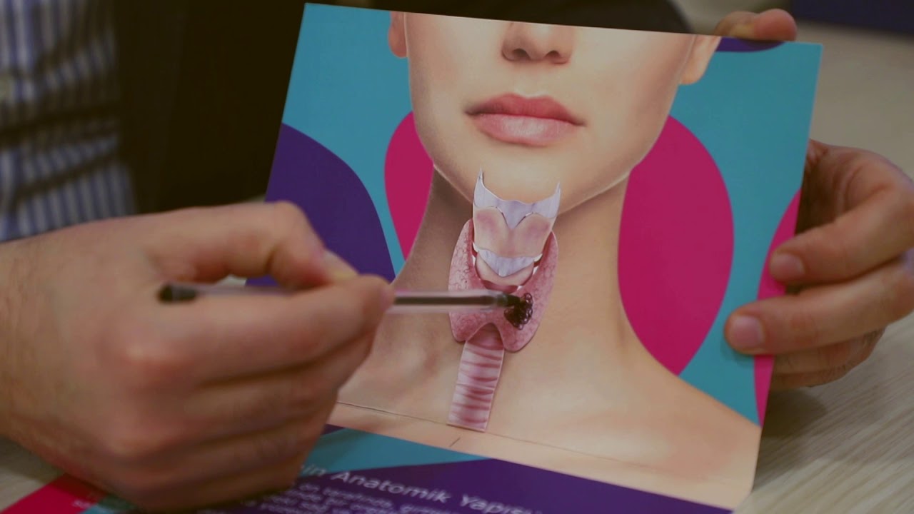 D&uuml;y&uuml;nl&uuml; zob nə zaman biopsiya olunmalı?
