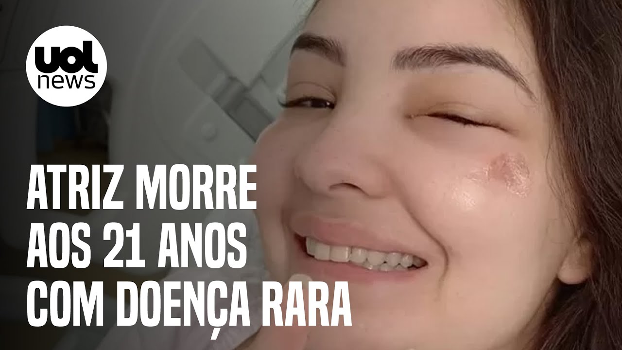 Atriz Mabel Calzolari morre aos 21 anos vítima de doença rara